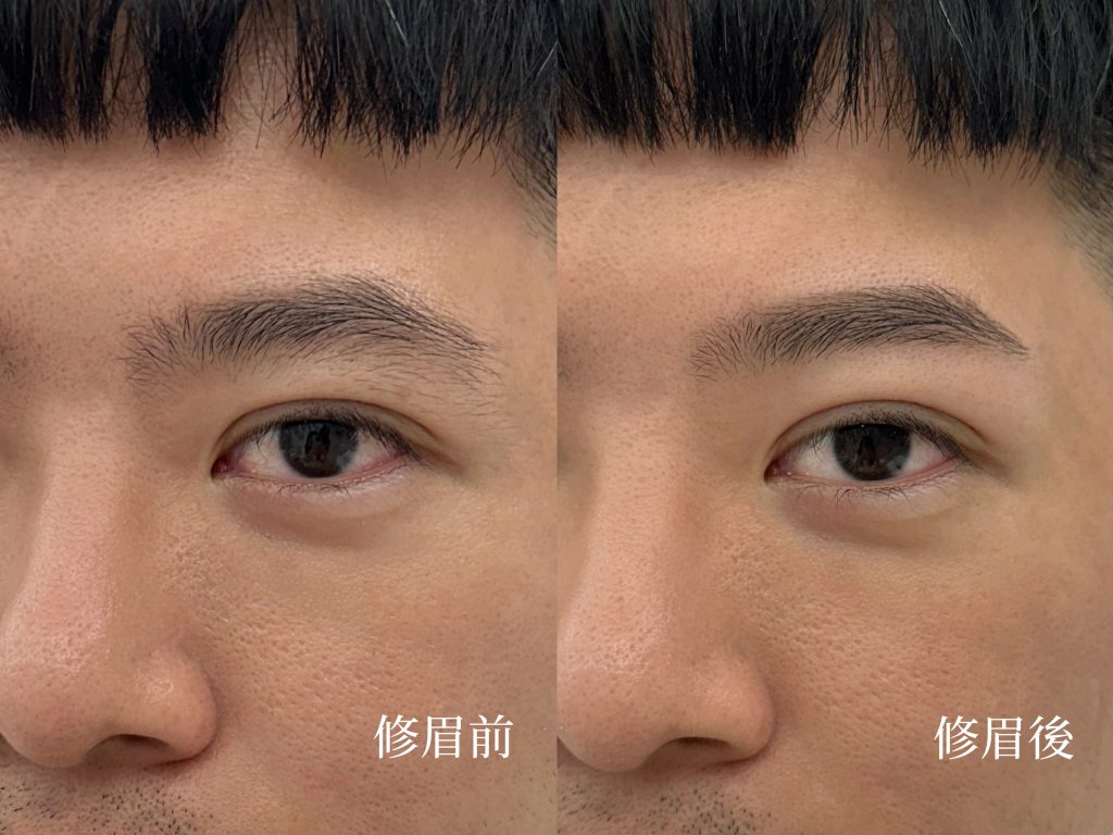 男生修眉前後對比照