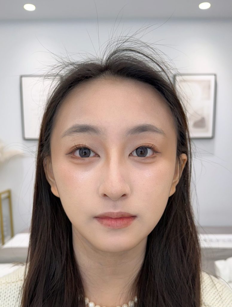 女性霧眉前天生狀態