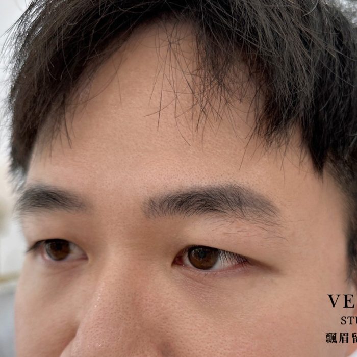 補飄眉前：一年留色狀況