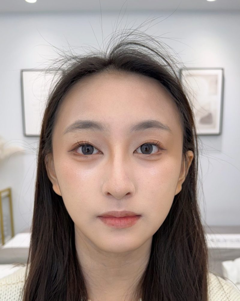 女性霧眉前天生狀態
